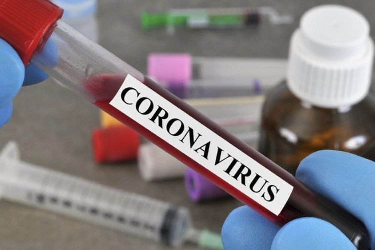 Azərbaycanda daha 4 170 nəfər koronavirusa yoluxub, 38 nəfər ölüb