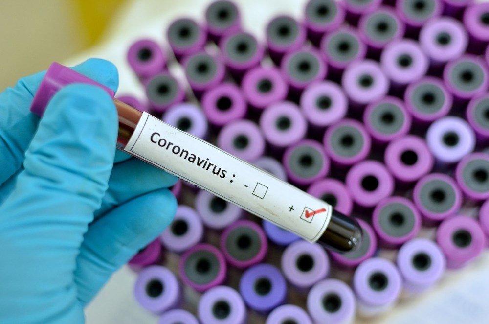 Türkiyədə son sutkada koronavirusdan 202 nəfər vəfat edib