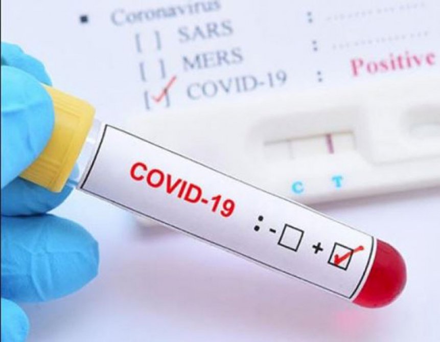 Dünyada ötən sutka koronavirusa yoluxanların sayı 794 mindən çox olub