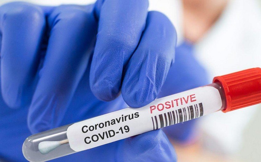 Azərbaycanda daha 1763 nəfər koronavirusa yoluxub, 20 nəfər ölüb